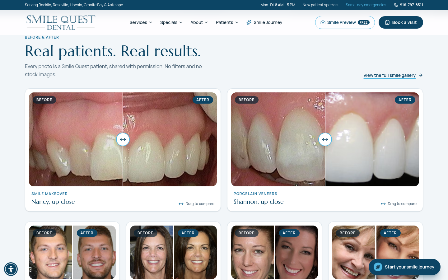 Smile Quest Dental before and after gallery with drag-to-compare sliders of real patients